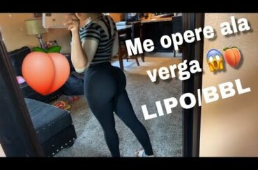 Bunny Vergashian LIPO/BBL Experiencia