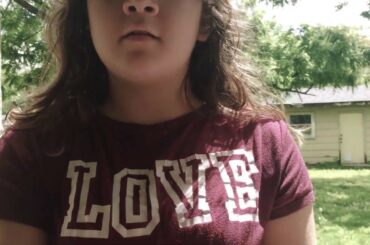 Two cute bunny’s that Survived in attack