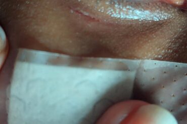 I was peacefully laying on my bed when a bunny hopped on my face.😑