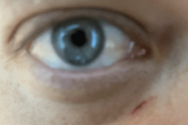 Does your bunny occasionally run across your face when you're asleep?