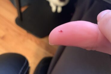 She’s the sweetest thing but sometimes she gets a little too excited for treats and takes a big ole chomp out of mommy