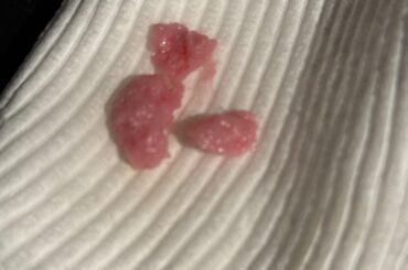 what is this?