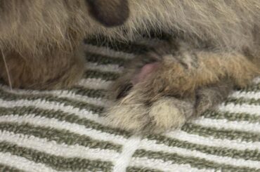 Top of the foot hair ?