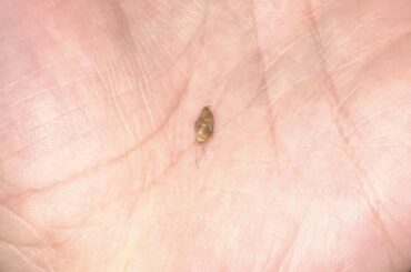 Found this in my buns ear