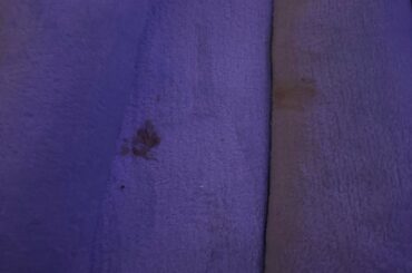 are small poop marks normal?