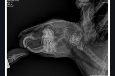 Any suggestions for crooked teeth