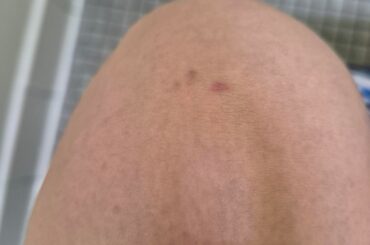 All I wanted was a kiss...