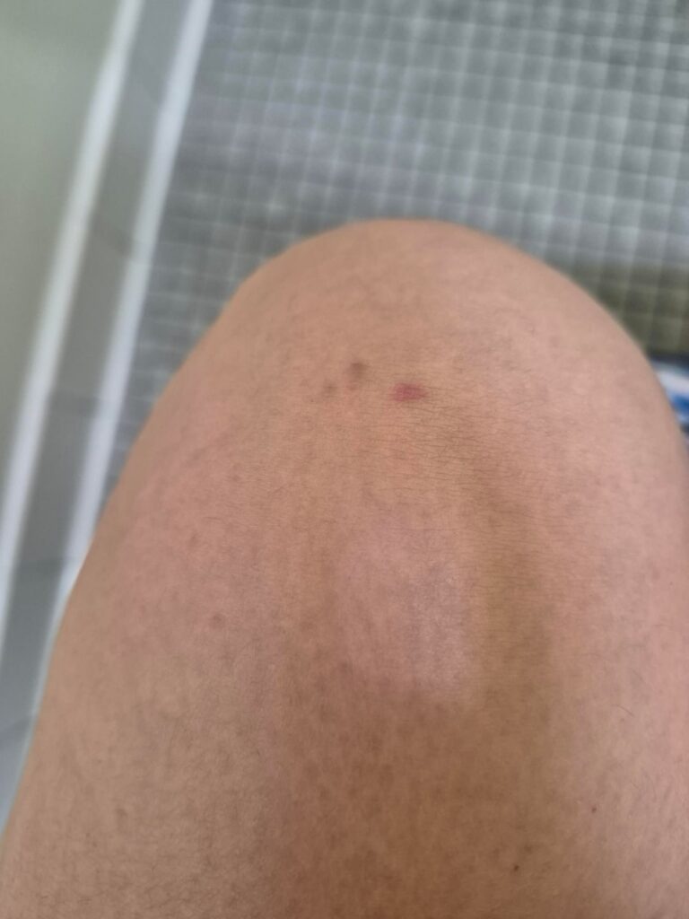 All I wanted was a kiss…