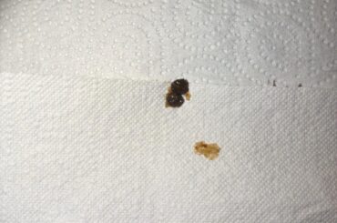 Bunny pooped this. Is this normal?