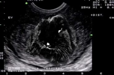found my old ultrasound